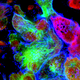 Illustration for article titled Math Suggests Most Cancers Are Caused By Bad Luck